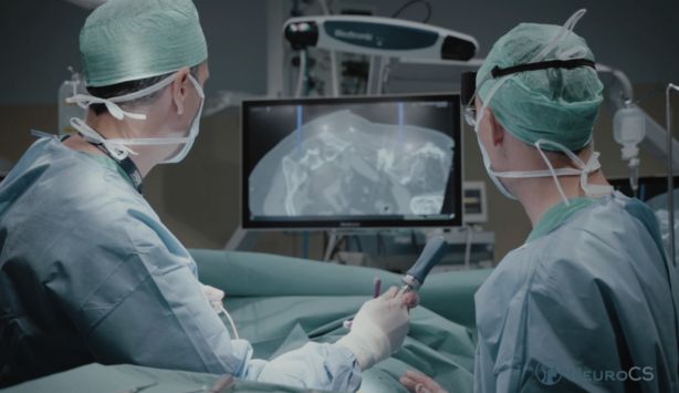 Neuronavegación para casos complejos. Equipo de NeuroCS recurriendo a la neuronavegación para una neurocirugía compleja.