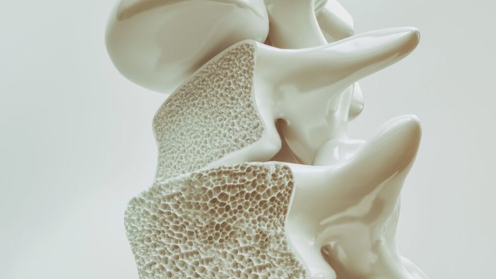 Preguntas frecuentes sobre calcio, osteoporosis y columna Preguntas frecuentes sobre calcio, osteoporosis y columna